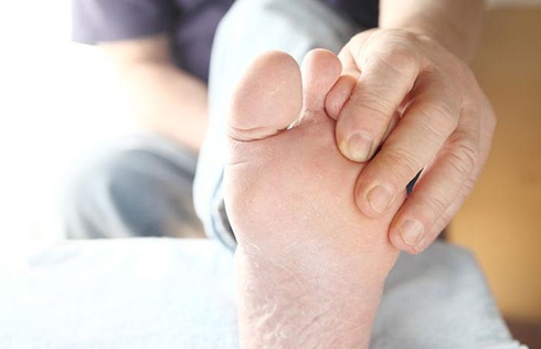 Painful Ingrown Toenail