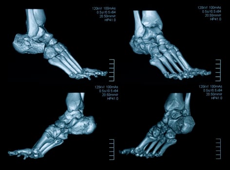 Medical Evaluation of the Foot And Ankle